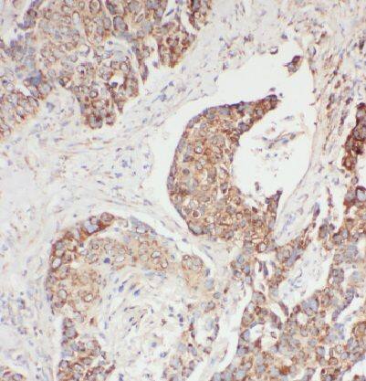 EDC4 Antibody - BSA Free