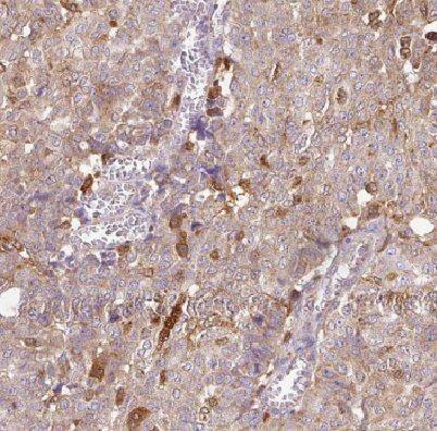 DYNLT3 Antibody - BSA Free