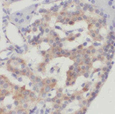 DYNLT1 Antibody - BSA Free