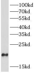 Dynein light chain 2a cytoplasmic Antibody - BSA Free