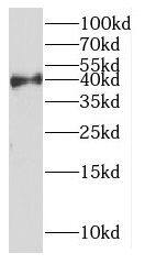 dynein, cytoplasmic 2, light intermediate chain 1 Antibody - BSA Free