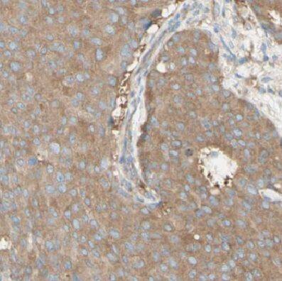 DYNC1H1 Antibody - BSA Free