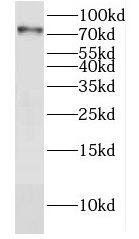 DYM Antibody - BSA Free