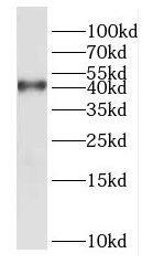DUSP9 Antibody - BSA Free