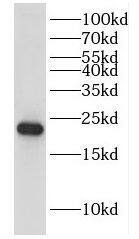 DUSP22 Antibody - BSA Free