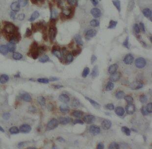DUSP19 Antibody - BSA Free
