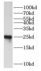 DUSP19 Antibody - BSA Free