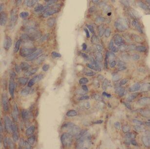 DUSP13 Antibody - BSA Free