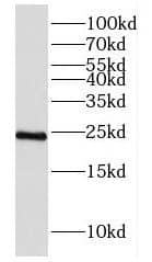 DUS4L Antibody - BSA Free