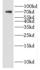 DTX4 Antibody - BSA Free