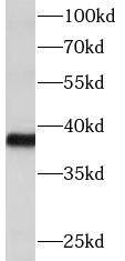DTX3 Antibody - BSA Free