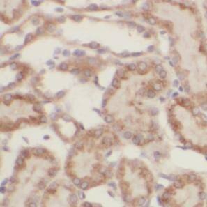 DTX3 Antibody - BSA Free