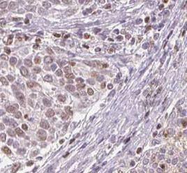 DSS1 Antibody - BSA Free