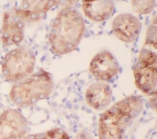 FIZ1 Antibody - BSA Free
