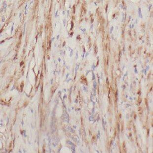 DOK4 Antibody - BSA Free