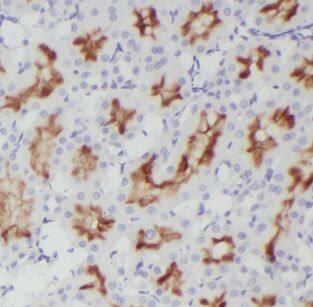 DOCK9 Antibody - BSA Free
