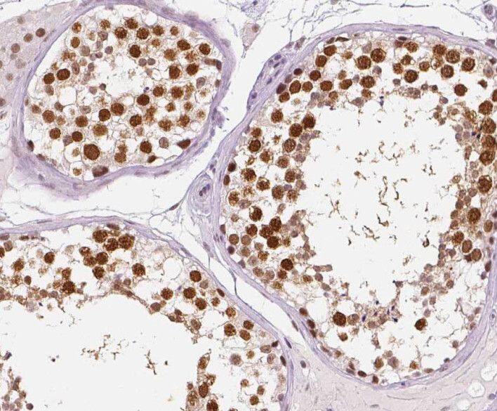 RTKN2 Antibody - BSA Free