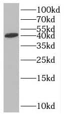 RTCD1 Antibody - BSA Free