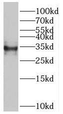 RSPH9 Antibody - BSA Free