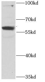 RPS6KL1 Antibody - BSA Free