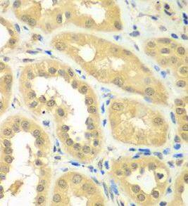 RPS6KL1 Antibody - BSA Free