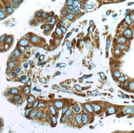 Ribosomal Protein S29 Antibody - BSA Free