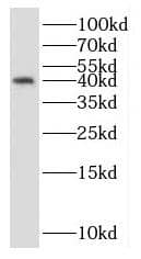 RPP40 Antibody - BSA Free