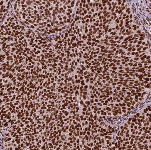 RPP25 Antibody - BSA Free