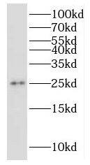 RPP25 Antibody - BSA Free