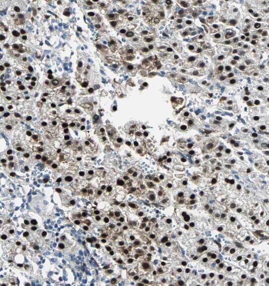 RPL7L1 Antibody - BSA Free