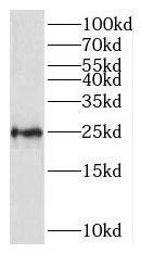 RPL10 Antibody - BSA Free