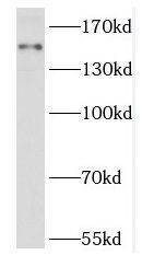RPGRIP1L Antibody - BSA Free