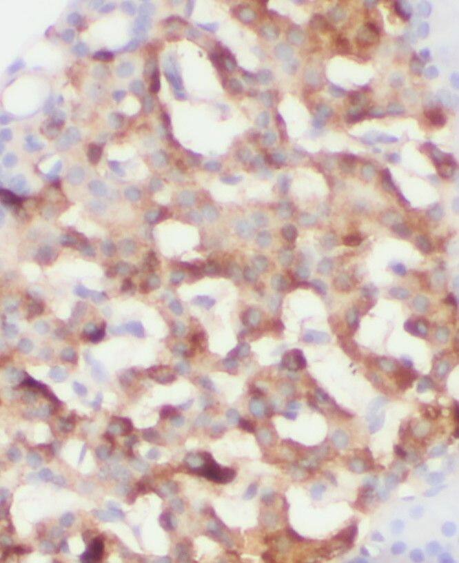 RPGRIP1L Antibody - BSA Free