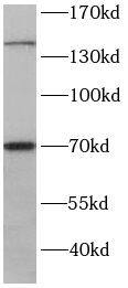 RPGRIP1 Antibody - BSA Free