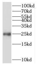 RPE Antibody - BSA Free
