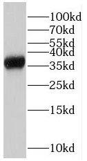 RPAIN Antibody - BSA Free