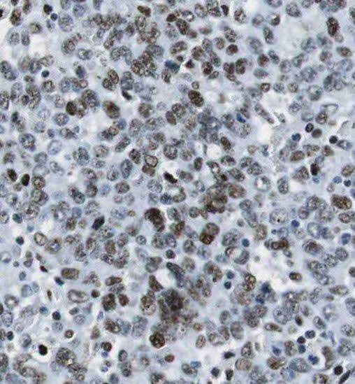 RPAIN Antibody - BSA Free