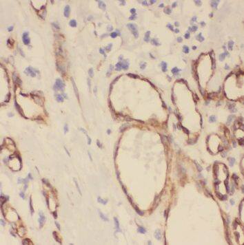 ROMO1 Antibody - BSA Free