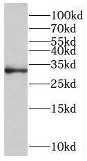 ROGDI Antibody - BSA Free