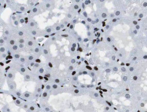 ROGDI Antibody - BSA Free