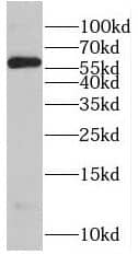 RNPS1 Antibody - BSA Free