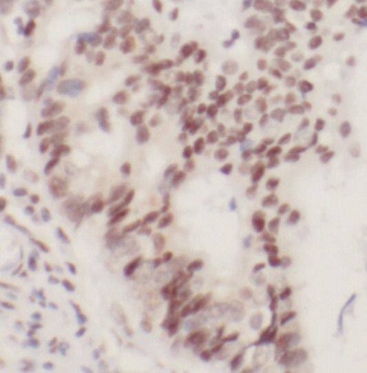 RNMT Antibody - BSA Free