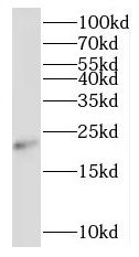 RNF212 Antibody - BSA Free