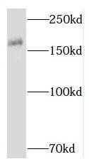 RNF17 Antibody - BSA Free