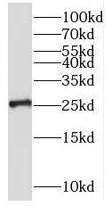 RNF151 Antibody - BSA Free