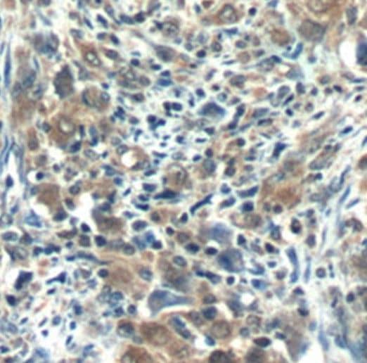 RNF125 Antibody - BSA Free