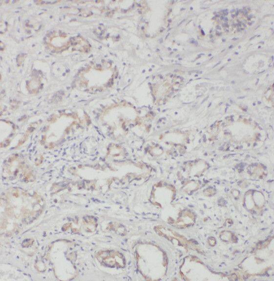 RND2 Antibody - BSA Free