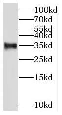 RNASEH2B Antibody - BSA Free