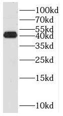 RMND5B Antibody - BSA Free