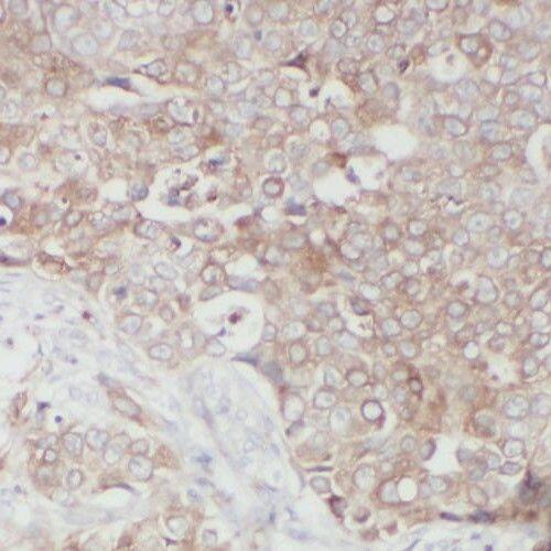 RINT1 Antibody - BSA Free